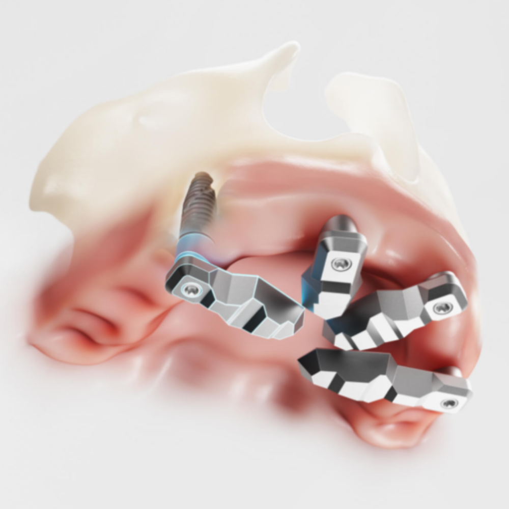 image Alliedstar DirectIP Scanbody kit